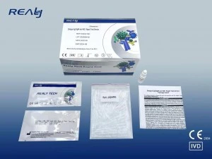 Deng Iggigm ak NS1 Rapid Tès Aparèy